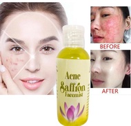 NEW TONER ACNE SAFFRON with LEMON 60 ml