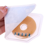 1PC *【Anti-Leakage Ring For Colostomy Bag】Ostomy Paste Ring Baseplates Stoma Care Leak-Proof Ring Fo