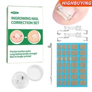 HIGHBUYING 1/2 Set Ingrown Toenail Corrector Tools Pedicure Recover Embed Toenail Treatment Professi