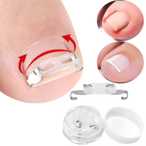 1/2Set Ingrown Toenail Corrector Tools Pedicure Recover Embed Toenail Treatment Nail Realignment Kit