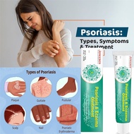Jemeesen Eczema Cream Psoriasis Ointment Chinese Herbal Antifungal Cream Antibacterial Antiviral Rel