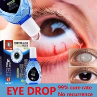 MATA Eye cleanser anti-dry eye therapy eye blocks dry eyes relieve eye fatigue eye freshener eyecare
