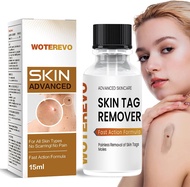 Skin Tag RemoverWart RemoverFreeze Off : Salicylic Acid Wart Remover for Men Women - Wart Removal fo