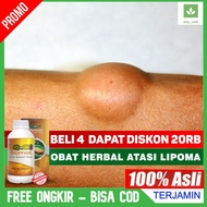 Natural Medicine for Lipomas, Lumps, Thyroid, Goiter, Boils, Lymph Nodes, Uci Uci QnC Jelly Gamat