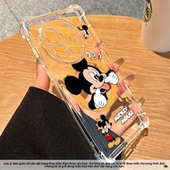 Guanglu | Ốp Lưng Chống Sốc cho OnePlus 13