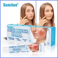 Sumifun Ointment Acne Acne Cream Skin Care Cream Manufacturer Spot Wholesale