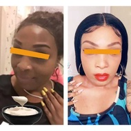 Skin Kojic Acid,Arbutin,Niacinamide,Hylauronic Acid, Serum Dark Spot Remover for Face Whitening Crea