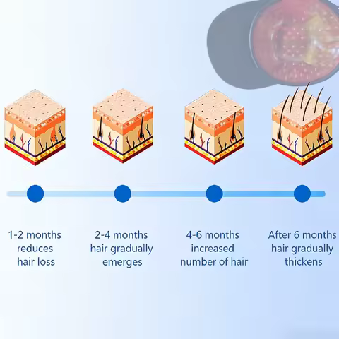 Professional 650nm LLLT Laser Cap Helmet, Hair Regrowth Therapy Device for Effective Follicle Activa