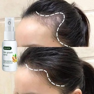 Serum penumbuh rambut Obat penumbuh rambut Penumbuh rambut botak Hair