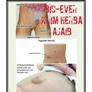 (READY STOCK) Cream sapu Masalah Angin Pasang @ Hernia.
