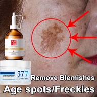 dark spot remover - 美白祛斑霜 - pigmentation remover 50g 祛斑霜 Pigmentation Remover Cream and Dark Spot Bl