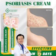 atoderma cream psoriasis original psoriasis treatment cream gamot sa kati kati sa balat buni ointmen