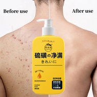 New Sulfur Mite-Removing Shower Gel Multifunctional Shower Gel Sulfur Shower Gel Mite-Removing Showe