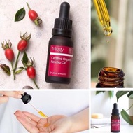 🌹Trilogy 玫瑰果油🌹