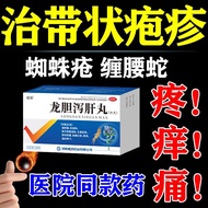 Medicine with Herpes] Snake Wrapped Waist Simple Herpes Virus Infection Intensive Blister Pain Genti