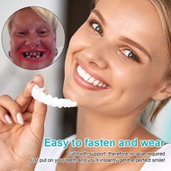 🌹SG High Quality🌹【Invisible braces retainer 】可调节卡扣式假牙Adjustable buckle dentures/Temporary Snap-on Br