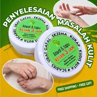 100% Natural Cost Eczema Cream, Herbal Eczema Cream, Moisturizing Cream