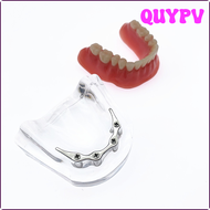 ฟันปลอมซ่อมแซม QUYPV พร้อมฝังพร้อมแท่งเงินฟันปลอมแบบจำลองขากรรไกรล่างทันตกรรมโมเดลการศึกษา APITV
