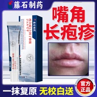 Angle Herpes Long Herpes Mouth Lips Water Foaming Pain Hot Stimulating Pain Fire Foaming Bad Mouth H
