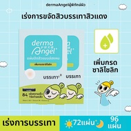 Derma angel | แผ่นแปะสิวกรดไฮดรอกซีสำหรับกำจัดสิวแบบไม่เห็น