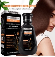 [ORIGINAL] PEIMEI Hair Growth Anti-Hair Loss Conditioner Anti-Dandruff Scalp Care Herbal Shampoo Biotin DHT Blocker for Oily Scalp &amp; All Hair Types Nourishing &amp; Moisturizing Hair Fall &amp; Oil Control Repairs Dry &amp; Damaged Hair Regrowth for Men &amp; Women 250ML