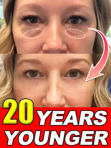 Instant Eye Bag Remover Gel-Cream Erase Bags Under Eyes | Dark Circle Corrector | 7 Days Visible