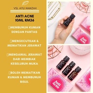 VSL ANTI ACNE ESSENCE JERAWAT KECUT