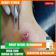 Obat Bisul Bernanah Obat Penghilang Bisul Obat Bisul Salep Obat Bisul Telur Kodok Bisul Kecil Jempol