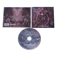 Cd - Vulvectomy - iberrant Vaginal Gestation