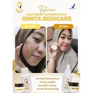 Terkini Dinita Skincare Glow/Acne