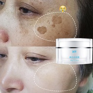 Krim jeragat whitening freckle cream dark spot remover freckles removal face cream whitening Moisturizer Anti Wrinkle祛斑霜