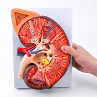 Human Kidney and Adrenal Gland Anatomy Model Pathological Lesion Teaching Aid