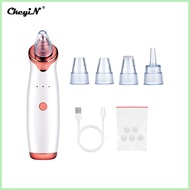 ▩ ⭐ ☃ Ckeyin Blackhead Remover Electric Vacuum Suction Blackhead Extractor Clean Tool with 4 Probe