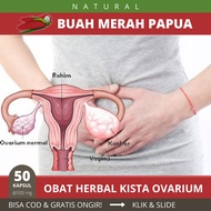 OIL FIT KAPSUL MINYAK BUAH MERAH PAPUA Obat Herbal Untuk Kista Ovarium Pembersih Cyst Penghancur dan