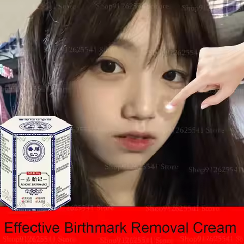 Birthmark Removal Cream Whitening Freckles Cream Facial Spots Skin Dark Spot Remover Melanin Anti-Pi