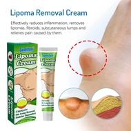lipoma cream benjolan ubat benjolan lipoma removal cream Removal Multiple Single Lipoma Subcutaneous