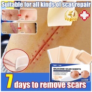 Medical Silicone Scar Sheet 4*7.5cm scar removal patch scar sheet /scar tape Self-adhesive Beauty St