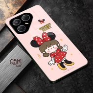 HP [GBM631] Softcase Glitter TECHNO CAMON 40 PRO 4G CAMON 40 4G POVA 5 POVA 7 5G POVA 6 PRO 5G Case 