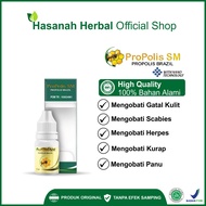 Propolis SM Medicine Herpes Itching Ringworm Henbal