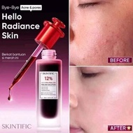 Skintific peeling solution