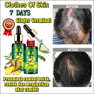 [PROMO 6.6]  7 days ginger germinal oil serum penumbuh rambut pria penumbuh rambut pria cepat tebal 