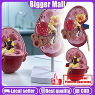 【READY STOCK】Kidney Model/Human Anatomy Adrenal/Adrenal Glands Magnification/Removable 2 Parts Kidne