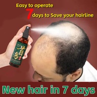 Hair growth serum, anti hair loss tonic, hair growth spray 100ml Hair Growth For Men And Women Anti 
