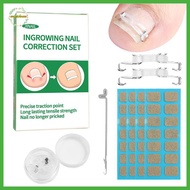 EPMN> 1/2 Set Ingrown Toenail Corrector Tools Pedicure Recover Embed Toenail Treatment Foot Care Cor