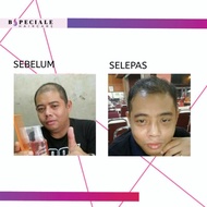 Hair Vitamin Serum By 1 Free 1