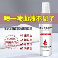 【宝贝当家旗舰店】 清洗剂  cleaning agent洗内衣女士内裤蛋白酶血渍净去姨妈血渍清洗剂床单血渍干洗剂免 【0413p1B9PCf09】