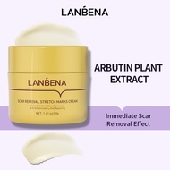 LANBENA Scar Removal Face Cream Scar Remover For old Scar on Body Stretch Marks Acne Pimple Marks Sc