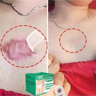 silicone scar sheet scar removal patch keloid scar plaster silicone gel scar patch stretch mark sili