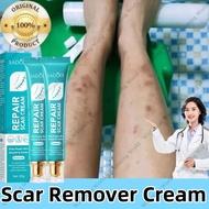 Scar remover peklat remover cream Suitable for old and new scars on body and face
