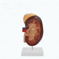 Human Kidney Adrenal Gland Section Model 2 Times Magnified Urinary System Teaching Tool